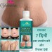 whitening cream