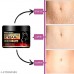 Stretch Marks Removal Cream | Reduces Marks & Scars | Post Pregnancy Marks Repair | Naturally Heal Pregnancy,Breast,Legs, Stretch marks | Made with Organic Ingredient